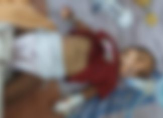 Rajkot: કેમ જીવ ચાલ્યો? શરદી ઉધરસ મટાડવા 10 માસની બાળકીને ગરમ સોયના ડામ અપાયા, હાલત ગંભીર