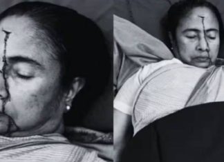 Mamata Banerjee ગંભીર રીતે ઇજાગ્રસ્ત, હોસ્પિટલમાં થયા દાખલ