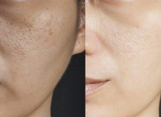 Skin Care: ઉનાળામાં ડલ સ્કીનની સંભાળ કેવી રીતે રાખવી, આ ટિપ્સ ઉપયોગી થશે